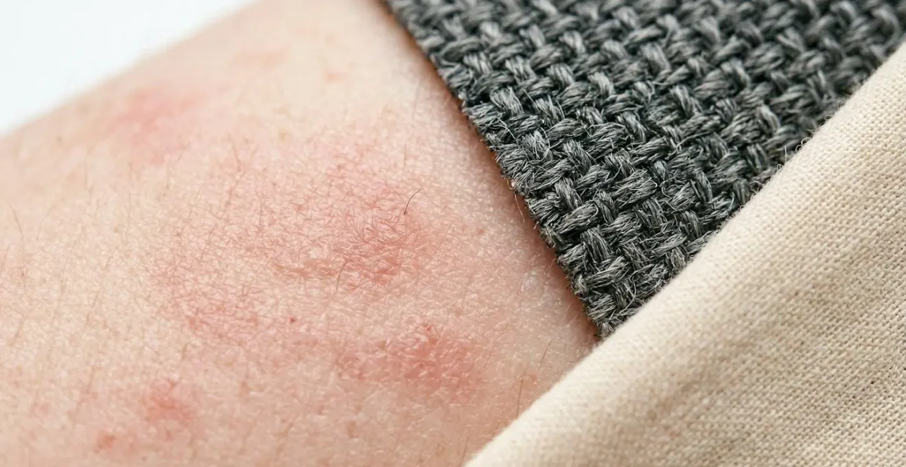 Primo piano di pelle sensibile con rossore e texture di diversi tessuti naturali e sintetici